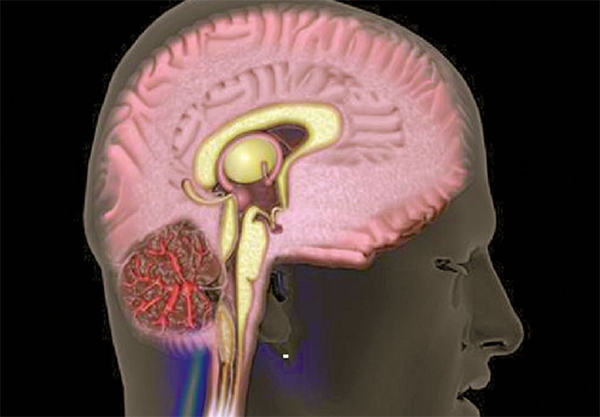 Как романтическая любовь влияет на мозг