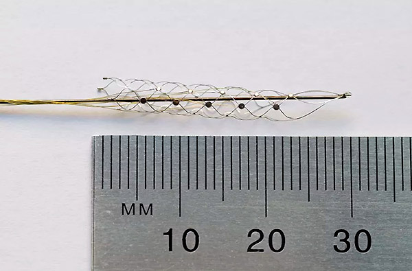 stentrode